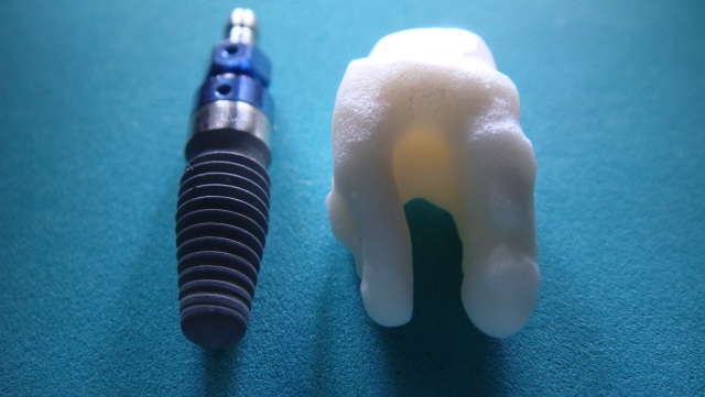 implants